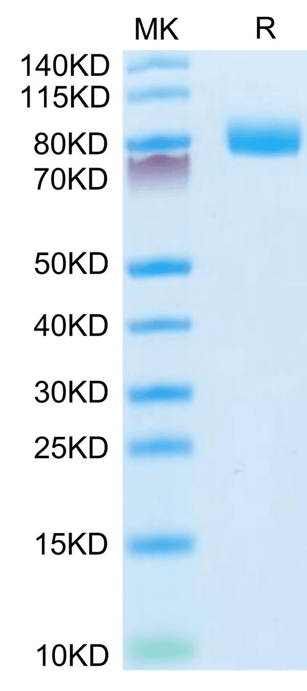 SDS-PAGE gel of Mouse CD10/MME Protein 3795