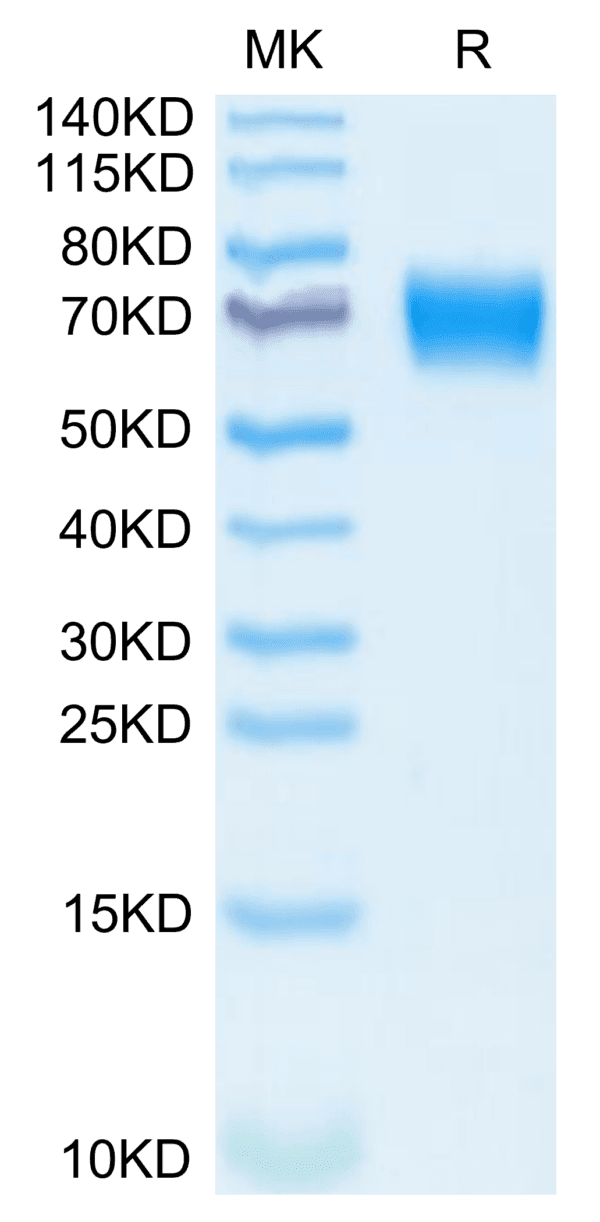 SDS-PAGE gel of Mouse IL-18 R1/CD218a Protein 3838