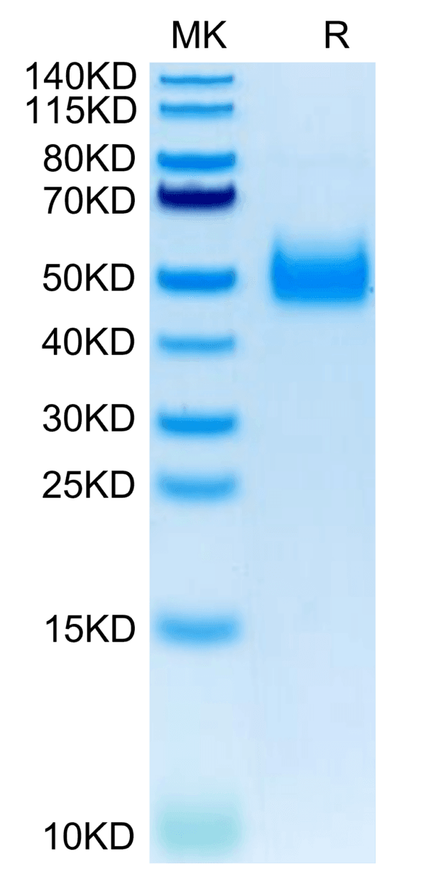 SDS-PAGE gel of Human IL-17RB Protein 3863