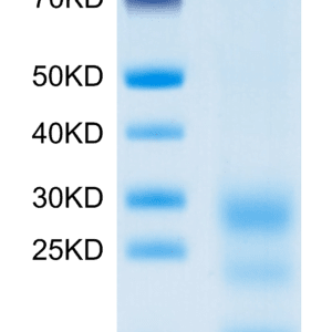 SDS-PAGE gel of Mouse BST2 Protein 3876