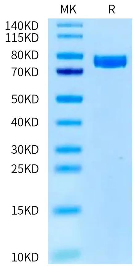 SDS-PAGE gel of Human KLKB1 Protein 3888