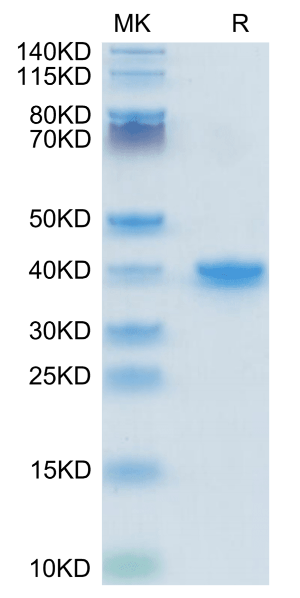 SDS-PAGE gel of Mouse TGF-alpha Protein 3894