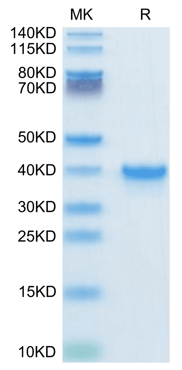 SDS-PAGE gel of Human TGF-alpha Protein 3896