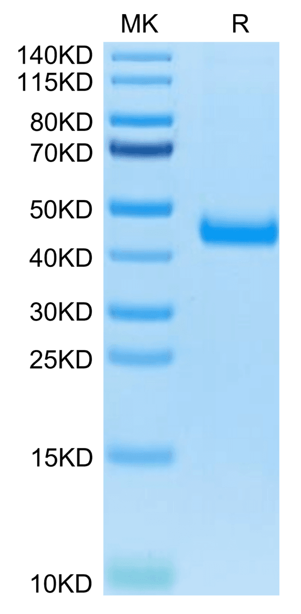 SDS-PAGE gel of Mouse IL-17RB Protein 3903