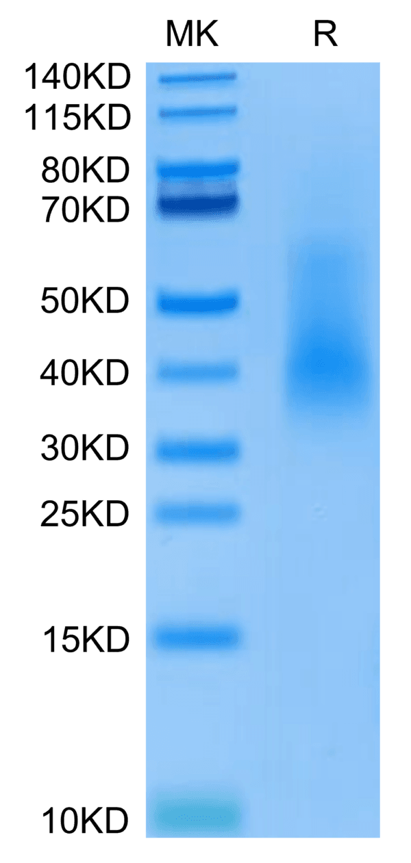 SDS-PAGE gel of Human RANKL/TNFSF11/CD254 Protein 3910