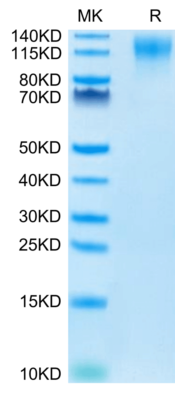 SDS-PAGE gel of Mouse CD96/TACTILE Protein 3920