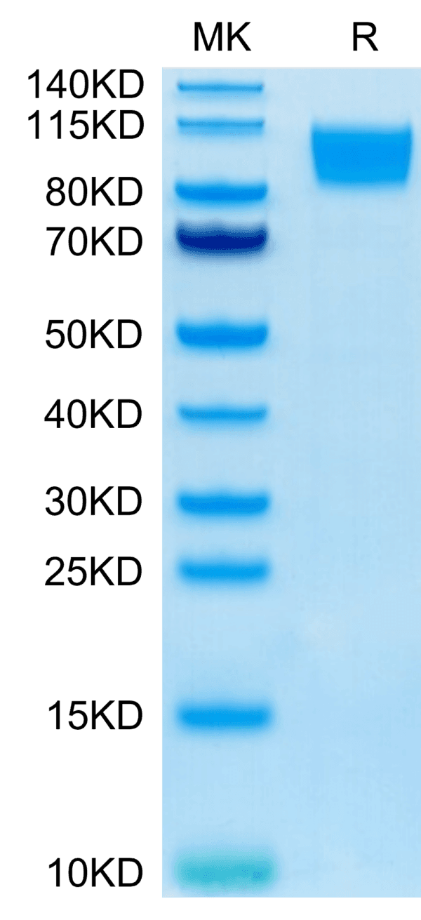 SDS-PAGE gel of Human GUCY2C/Guanylyl cyclase C Protein 3923