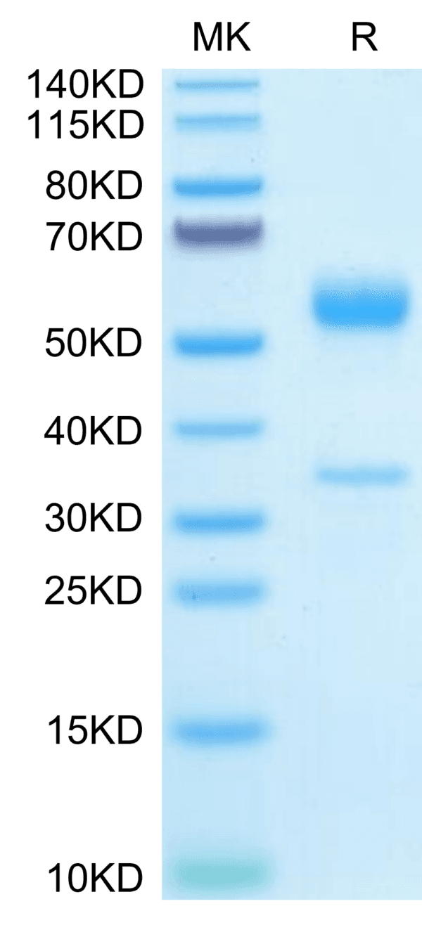 SDS-PAGE gel of Mouse PGF Protein 3925