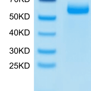 SDS-PAGE gel of Mouse Adiponectin/Acrp30 Protein 3928