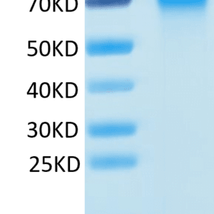 SDS-PAGE gel of Mouse DR6/TNFRSF21 Protein 3944