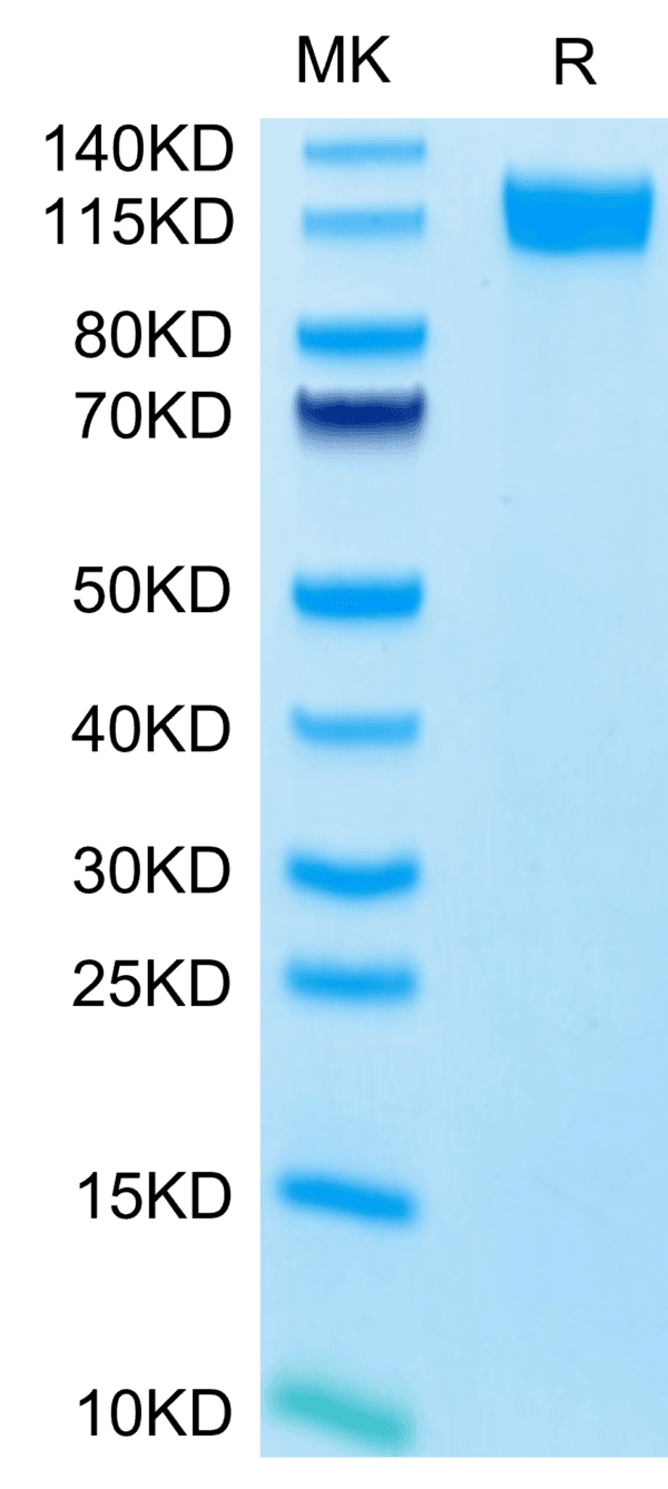 SDS-PAGE gel of Human E-Selectin/CD62E Protein 3945