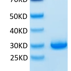 SDS-PAGE gel of Human VSIG8 Protein 3946