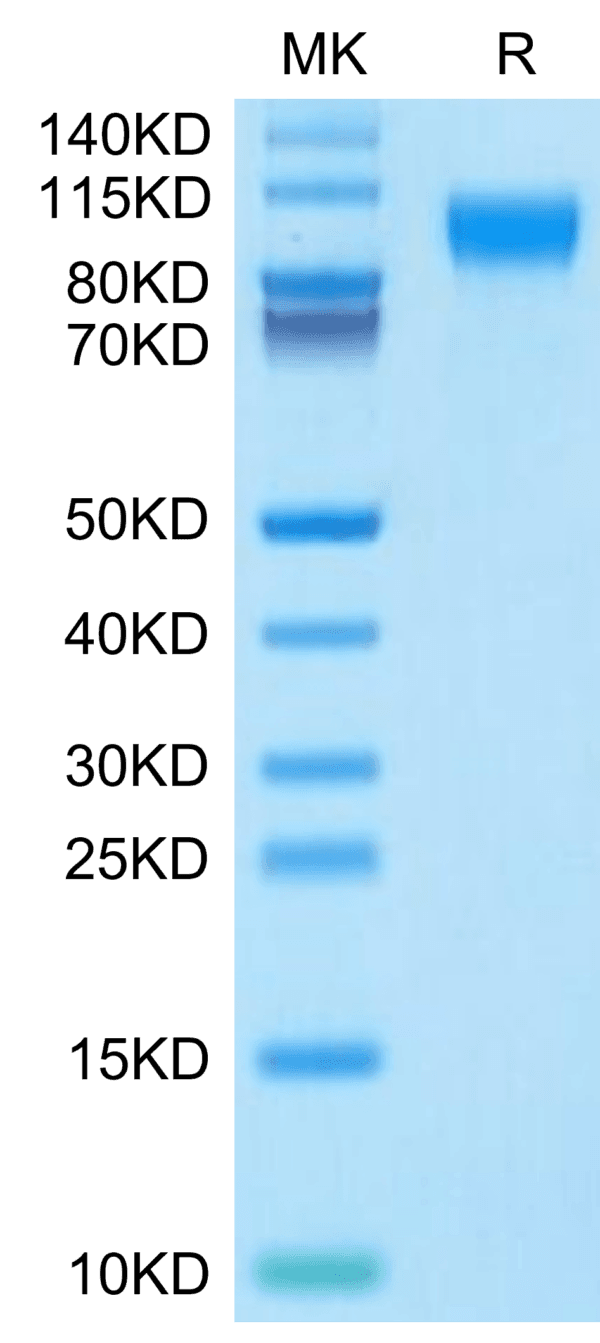 SDS-PAGE gel of Mouse IL-31 RA?Protein 3955