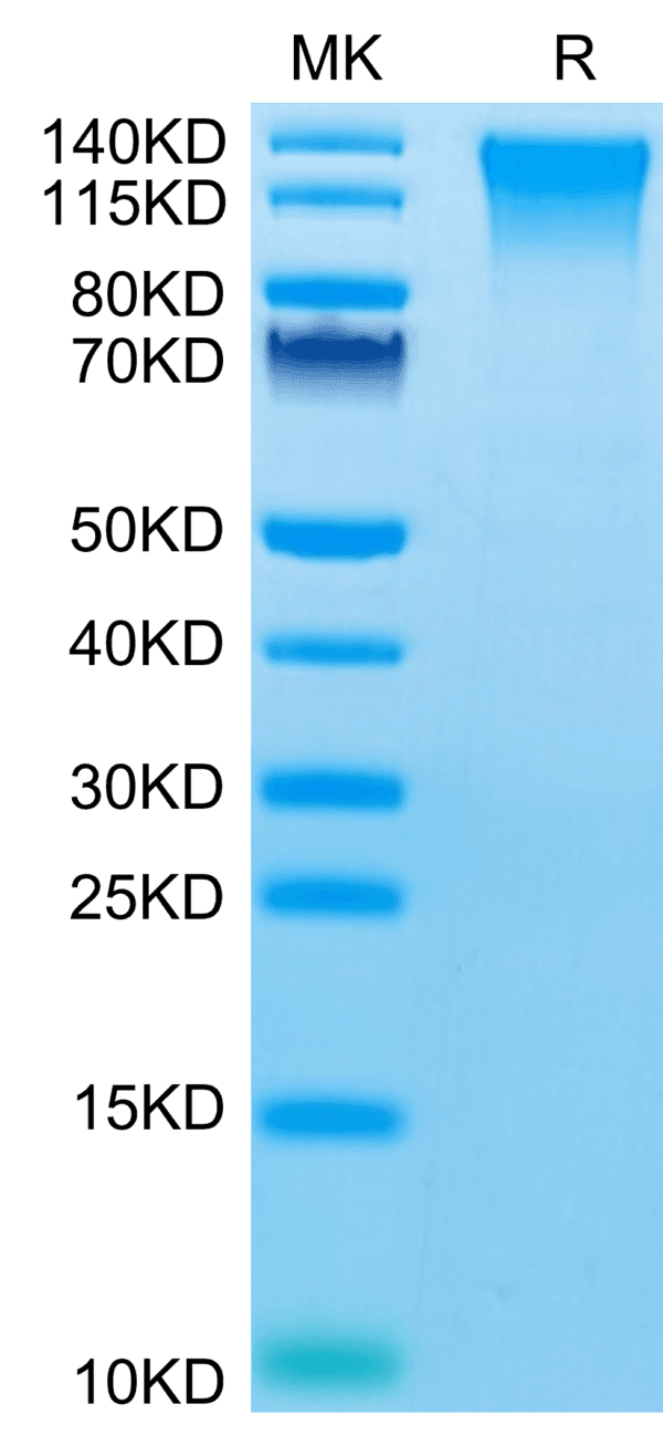 SDS-PAGE gel of Mouse TEM1/cd248 Protein 3959