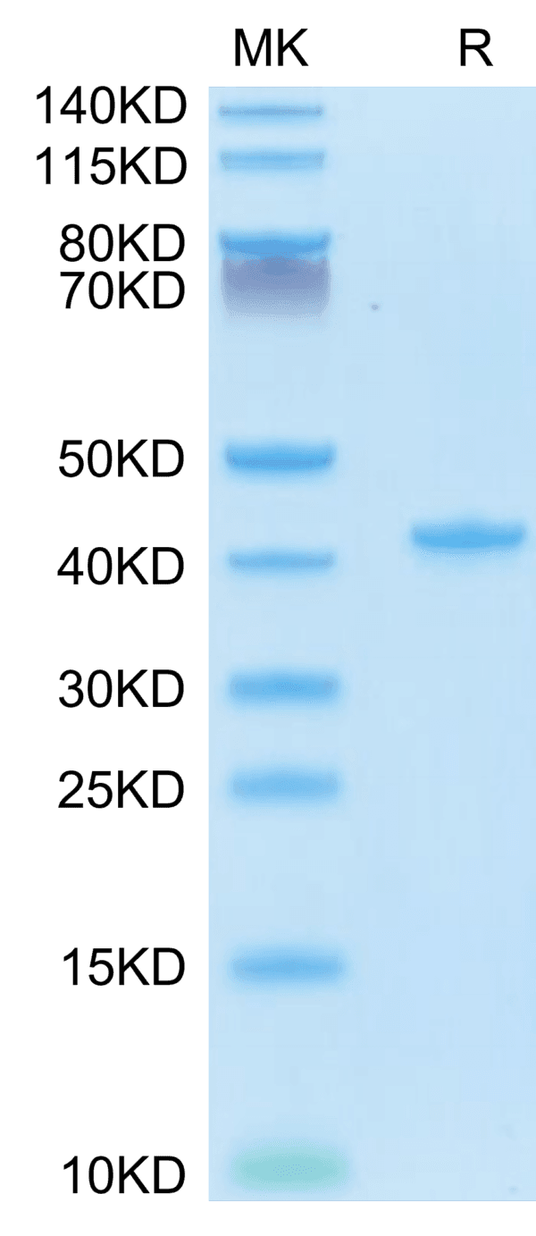 SDS-PAGE gel of Mouse CCL5 Protein 3962