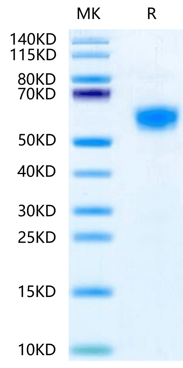 SDS-PAGE gel of Mouse IL-18RAP Protein 3970