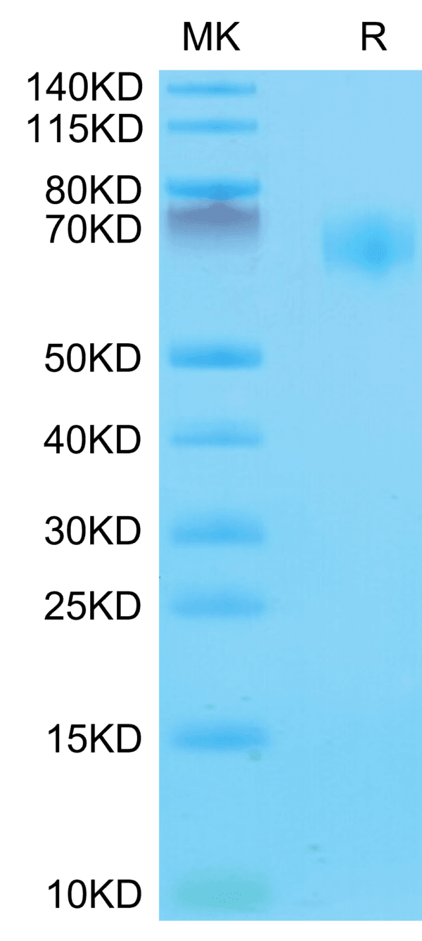 SDS-PAGE gel of Mouse IL-18BP Protein 3979