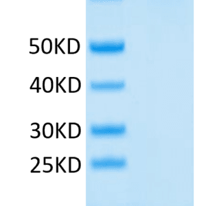 SDS-PAGE gel of Human CD43 Protein 3981