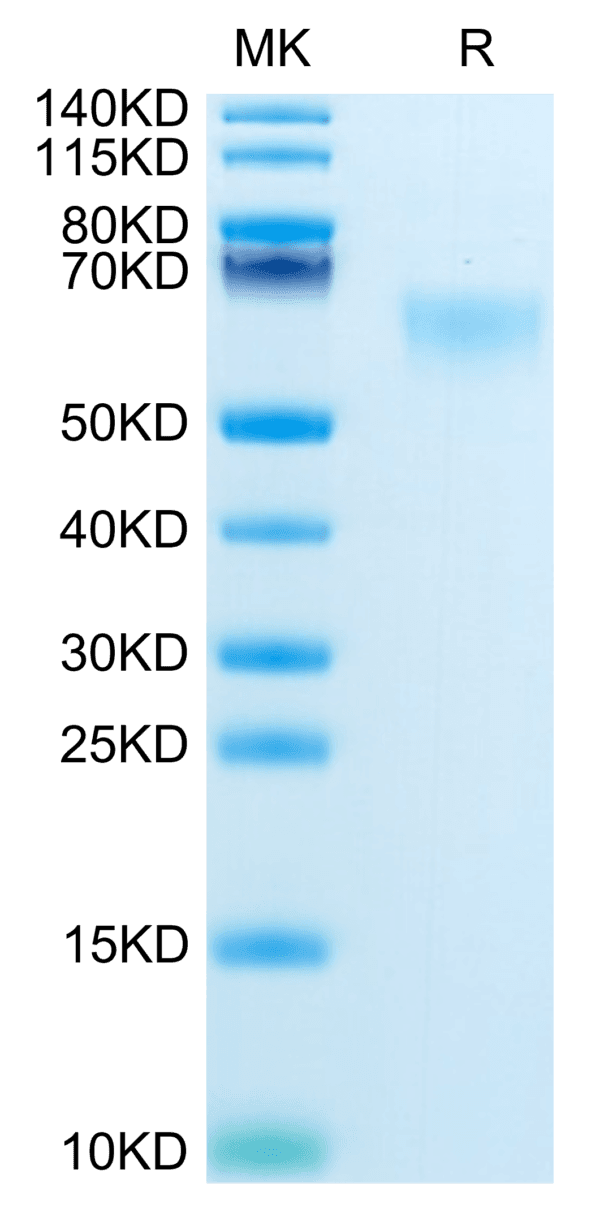 SDS-PAGE gel of Mouse MADCAM1 Protein 3982