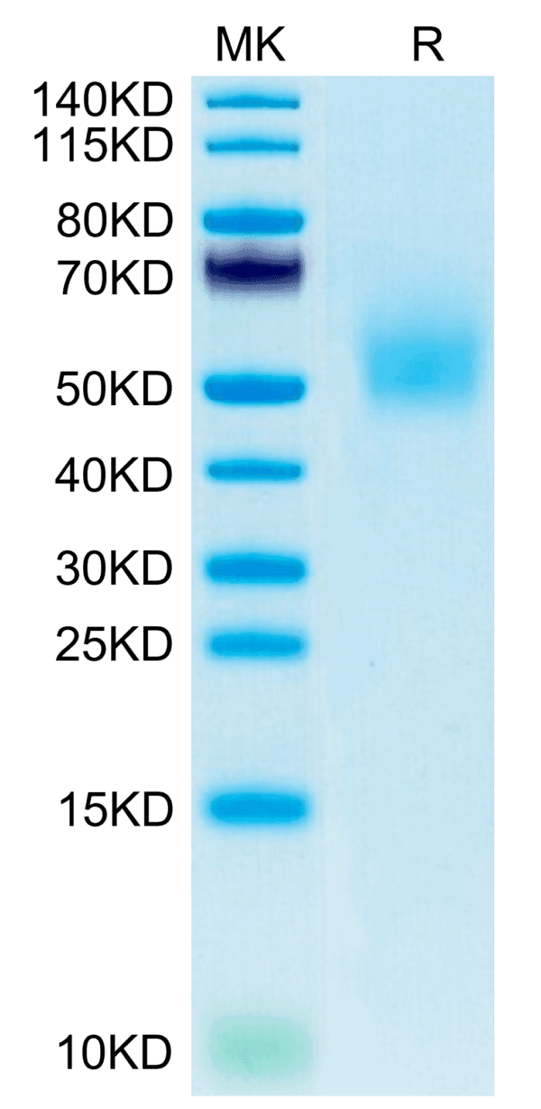 SDS-PAGE gel of Mouse DLK1 Protein 3984