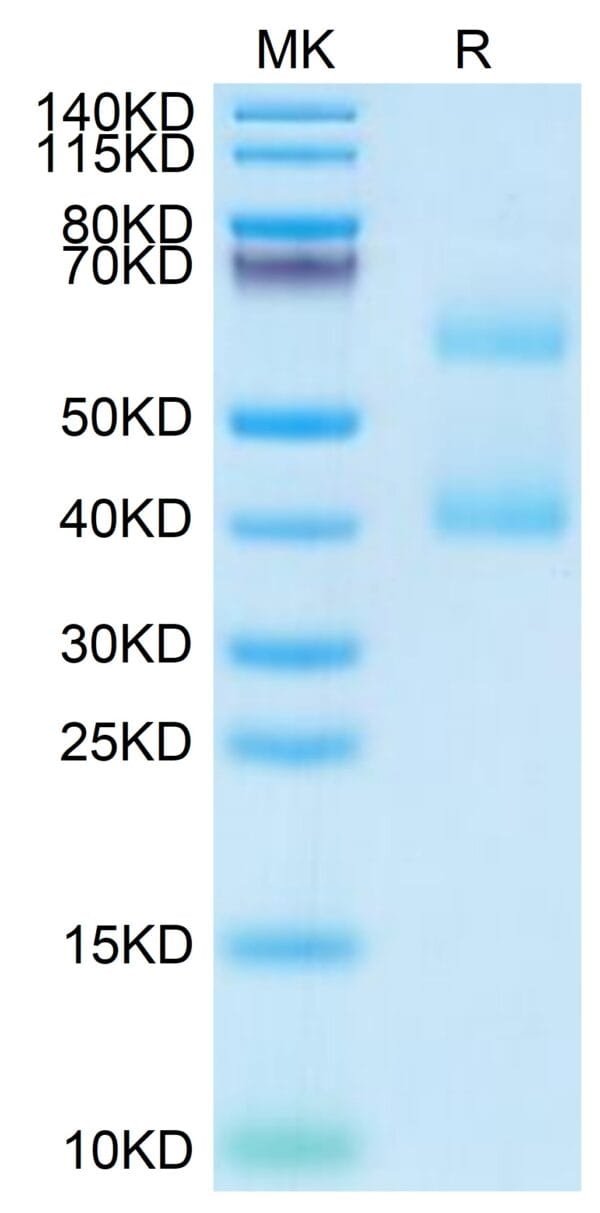 SDS-PAGE gel of Mouse MEPE Protein 3987