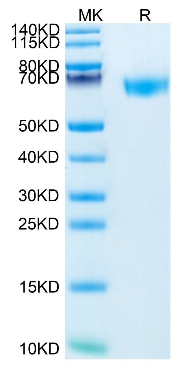 SDS-PAGE gel of Mouse ROBO4 Protein 3996