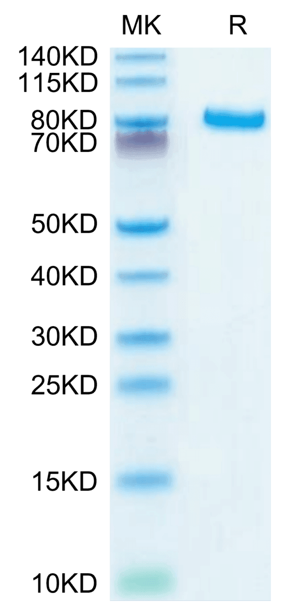 SDS-PAGE gel of Human DLL4 Protein 4003