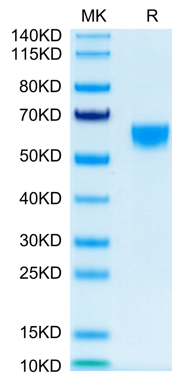 SDS-PAGE gel of Mouse IL-9?Protein 4011