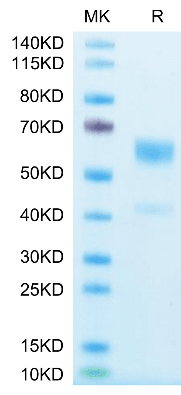 SDS-PAGE gel of Human IL-9?Protein 4024