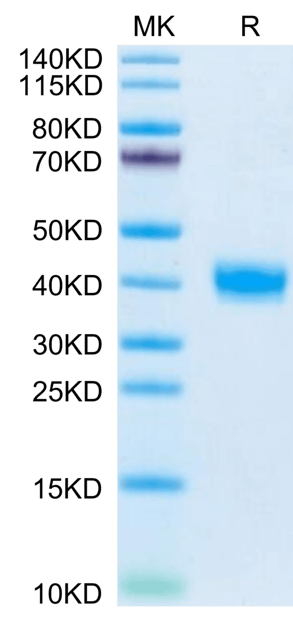 SDS-PAGE gel of Mouse PRLR Protein 4031