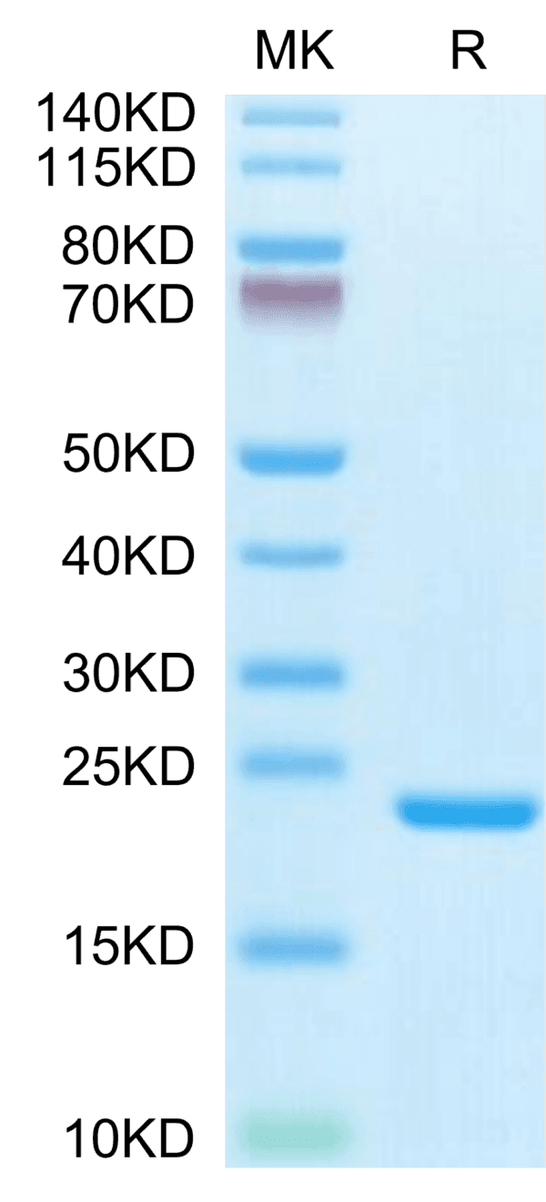 SDS-PAGE gel of Biotinylated Human IL-1 Beta/IL-1F2 Protein 4045