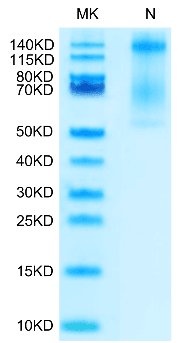 SDS-PAGE gel of Biotinylated Human HLA-E*01:03&B2M&Peptide (VMAPRTLVL)  4080