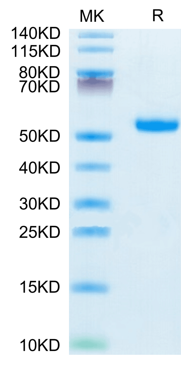 SDS-PAGE gel of Mouse IL-5 R alpha/CD125 Protein 4092