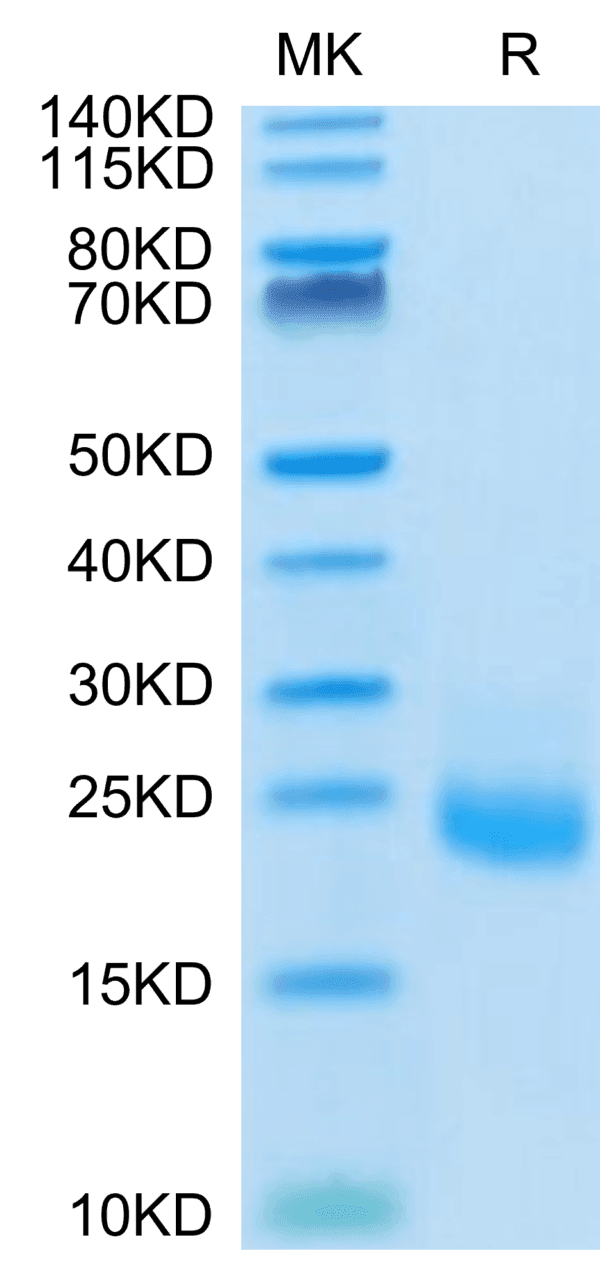 SDS-PAGE gel of Human IL-31 Protein 4097