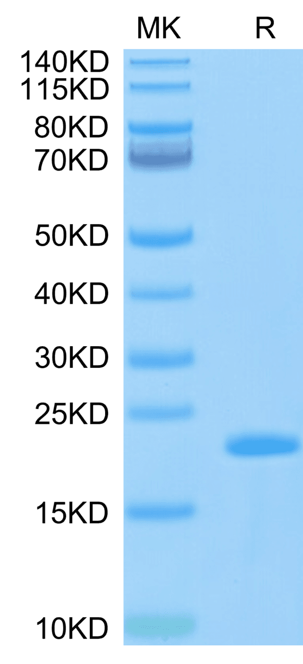 SDS-PAGE gel of Biotinylated SARS-COV-2 Nucleocapsid Protein CTD Domain 4101