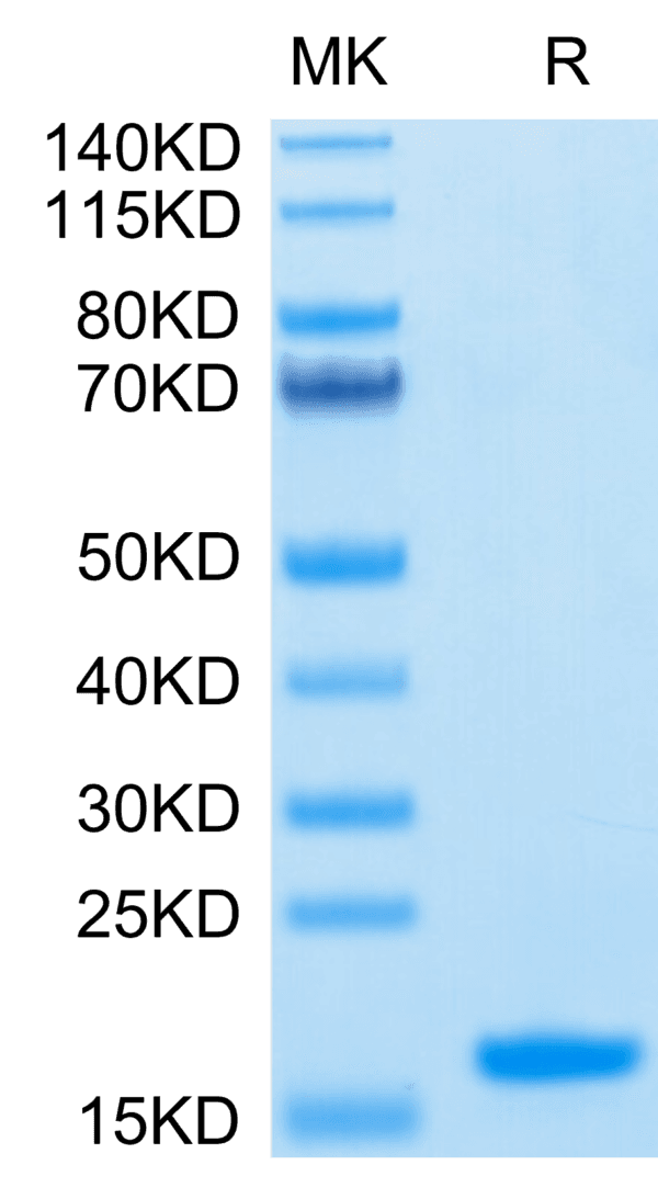 SDS-PAGE gel of Human Nectin-4 Protein IgV Domain 4104