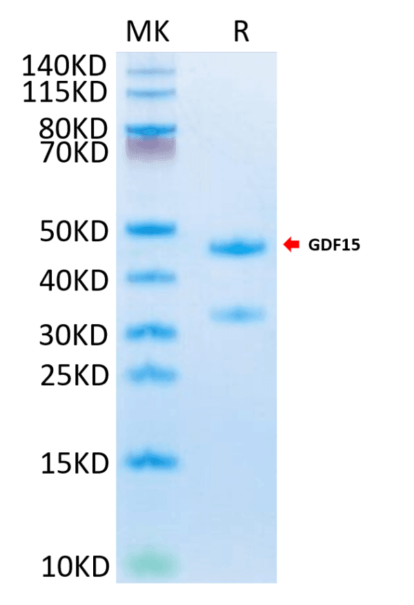 SDS-PAGE gel of Mouse GDF15 Protein 4122