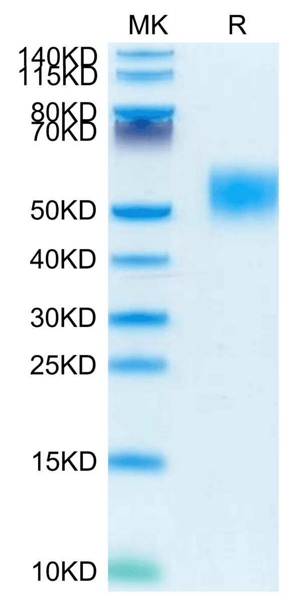 SDS-PAGE gel of Mouse GM-CSF R alpha Protein 4145