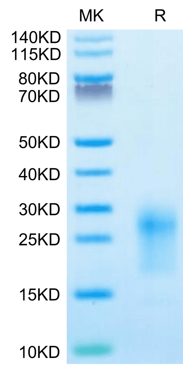 SDS-PAGE gel of Mouse TIGIT Protein 4157