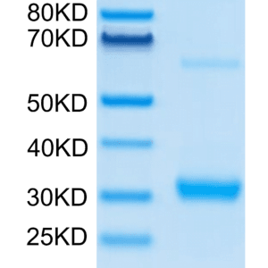 SDS-PAGE gel of Human CLEC10A Protein 4169