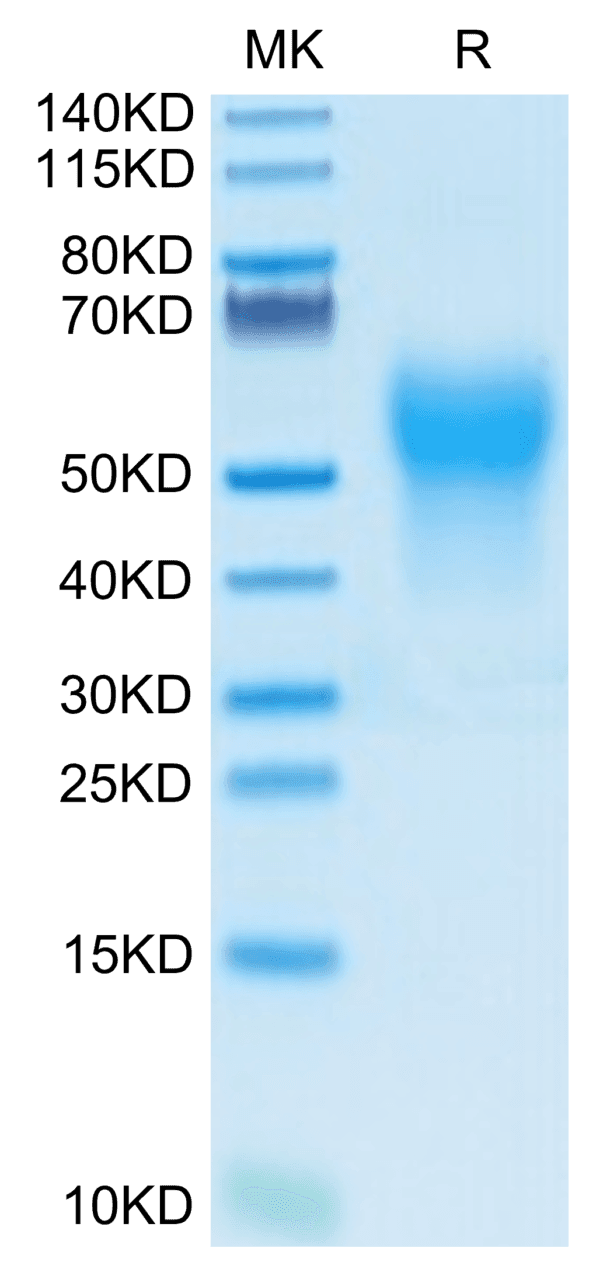 SDS-PAGE gel of Biotinylated Human IL-18BP Protein 4178