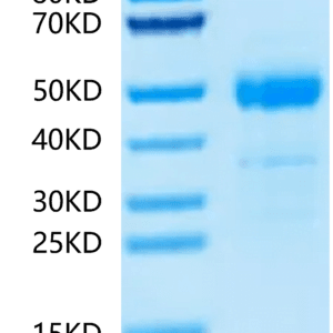 SDS-PAGE gel of Human ST3GAL4 Protein 4189