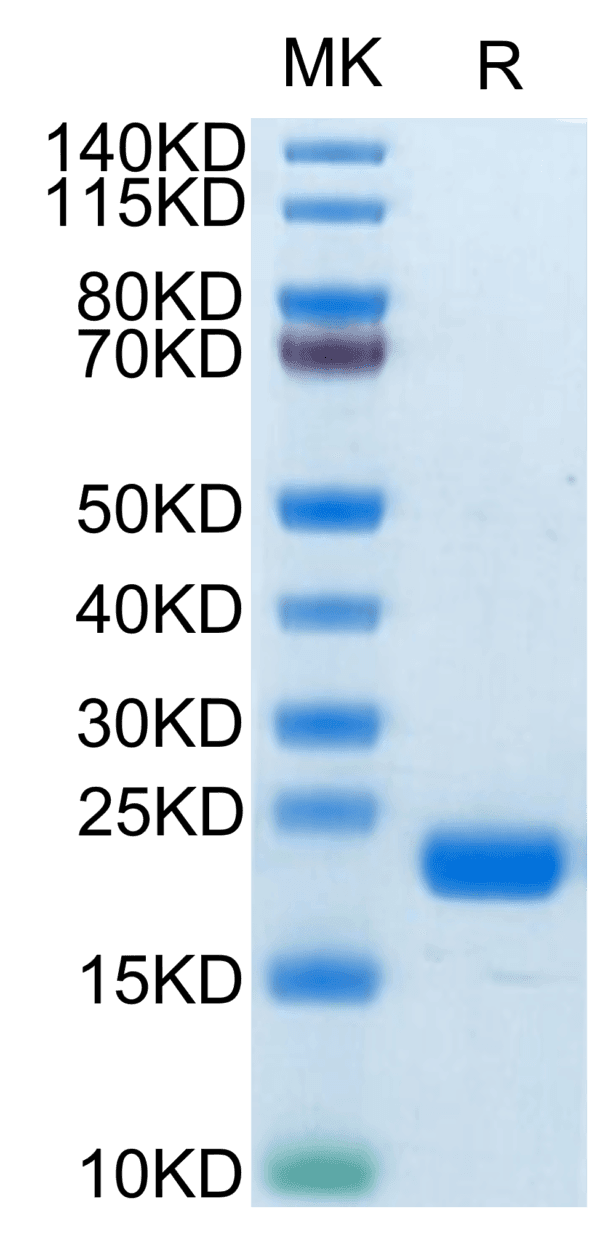 SDS-PAGE gel of Biotinylated Human CD20/MS4A1 Protein 4206