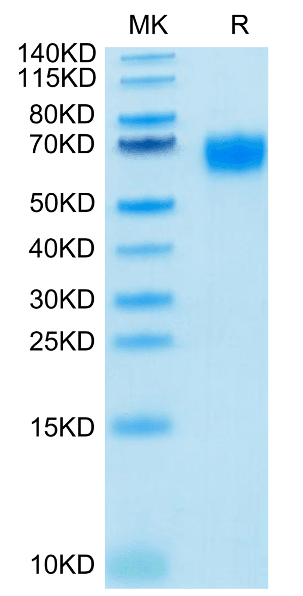 SDS-PAGE gel of Biotinylated Human IL-2 R gamma/CD132 Protein 4210