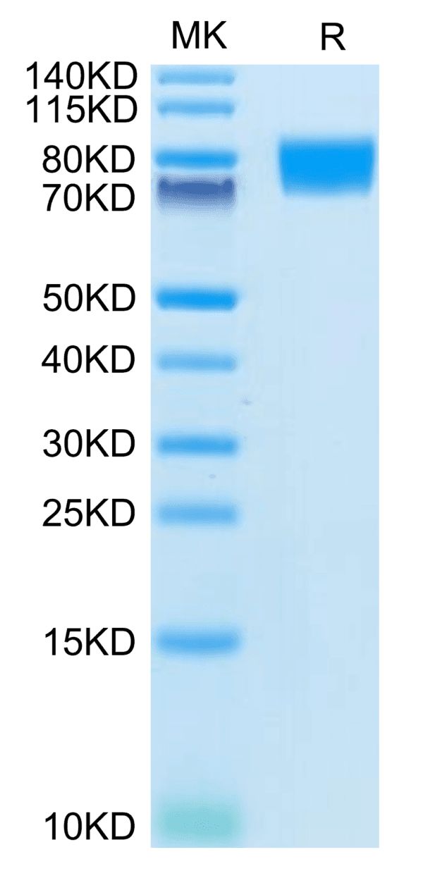 SDS-PAGE gel of Human CD117 Protein 4212