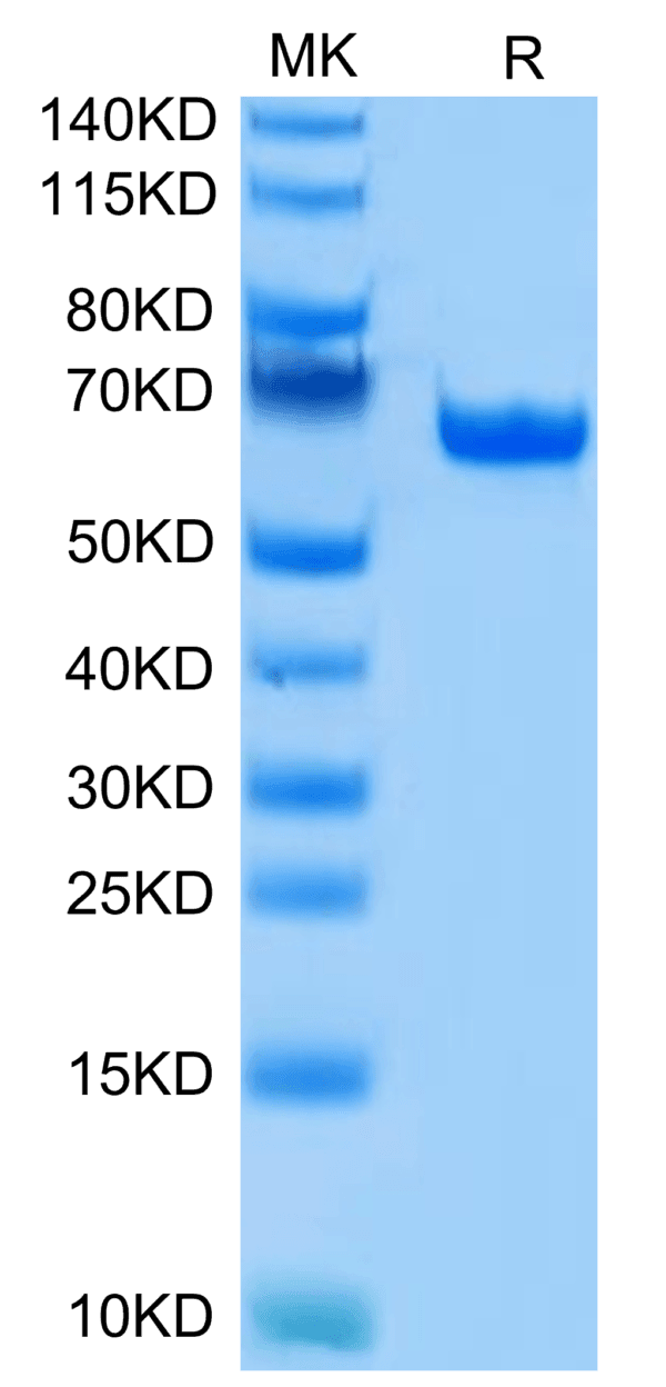 SDS-PAGE gel of Human BTN1A1/Butyrophilin Protein 4215