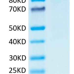 SDS-PAGE gel of Human CD31/PECAM-1 Protein 4284