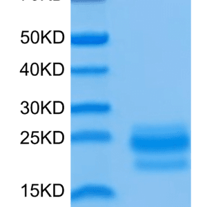 SDS-PAGE gel of Human CD99/MIC2 Protein 4288