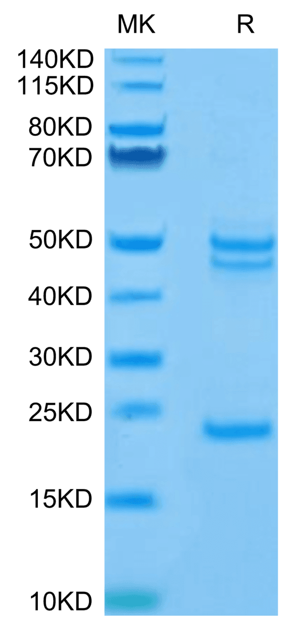 SDS-PAGE gel of Mouse IL-23 alpha&IL-12 beta Protein 4293