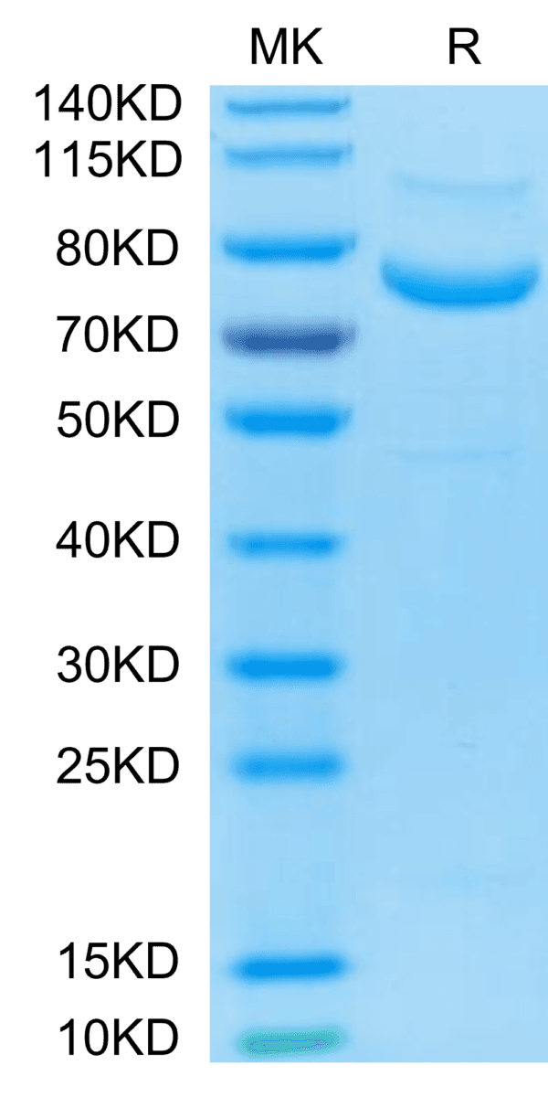 SDS-PAGE gel of Biotinylated Human LRRC15/LIB Protein 4296